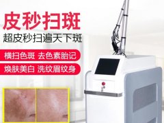 賽諾秀蜂窩皮秒機(jī)器多少錢一臺？755超皮秒機(jī)器設(shè)備價格報價